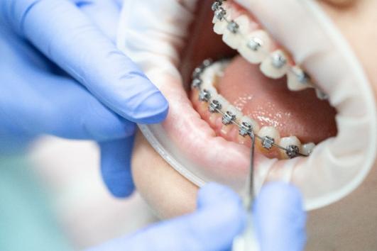 Orthodontie pour enfants