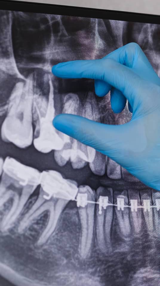 clinique dentaire à Bruxelles 