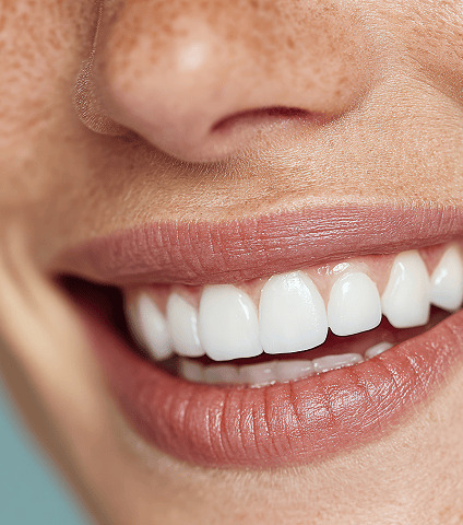 Blanchiment dentaire